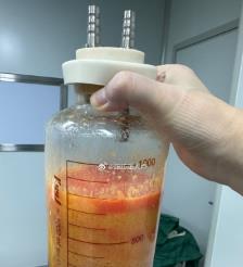 铜川水动力吸脂手术要做多久？